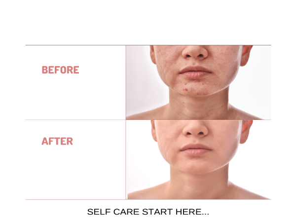 Organic Under Eye Youth Corrector and Neck Renewal Cream Duo - For Women-2