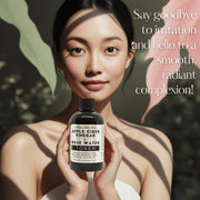 Apple Cider Vinegar + Rose Water Toner - Prevent Breakouts and  Minimize Blemishes with  Soothing Lavender Oil-4